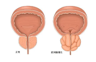 两性健康 | 对于女性来说，最怕男人得什么病？(图1)