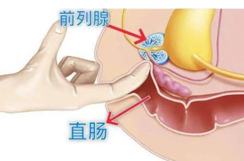 是时候重视了，1分钟自测前列腺健康，达标的不多